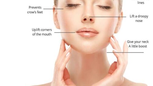 Benefits of BOTOX treatments